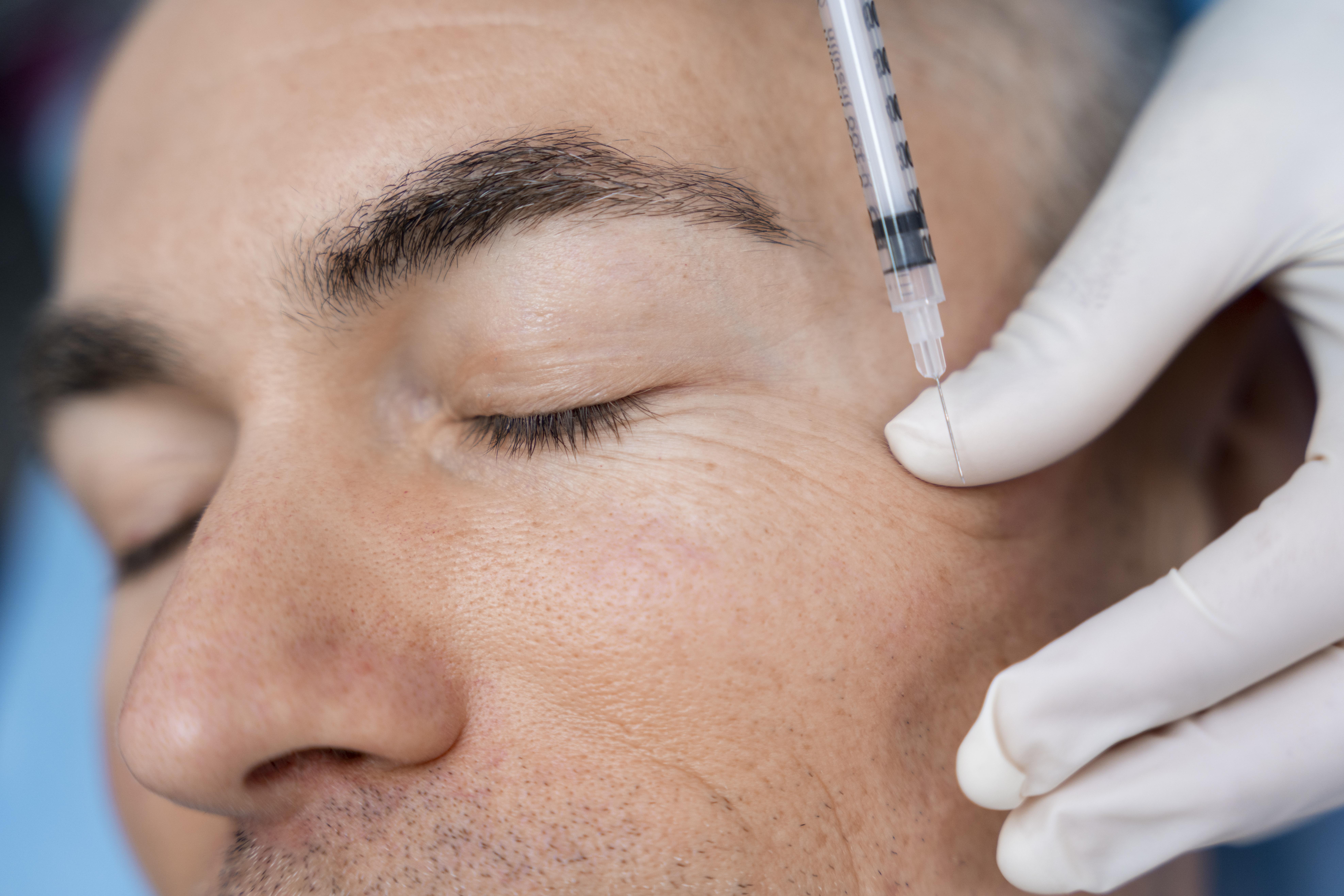 Botox