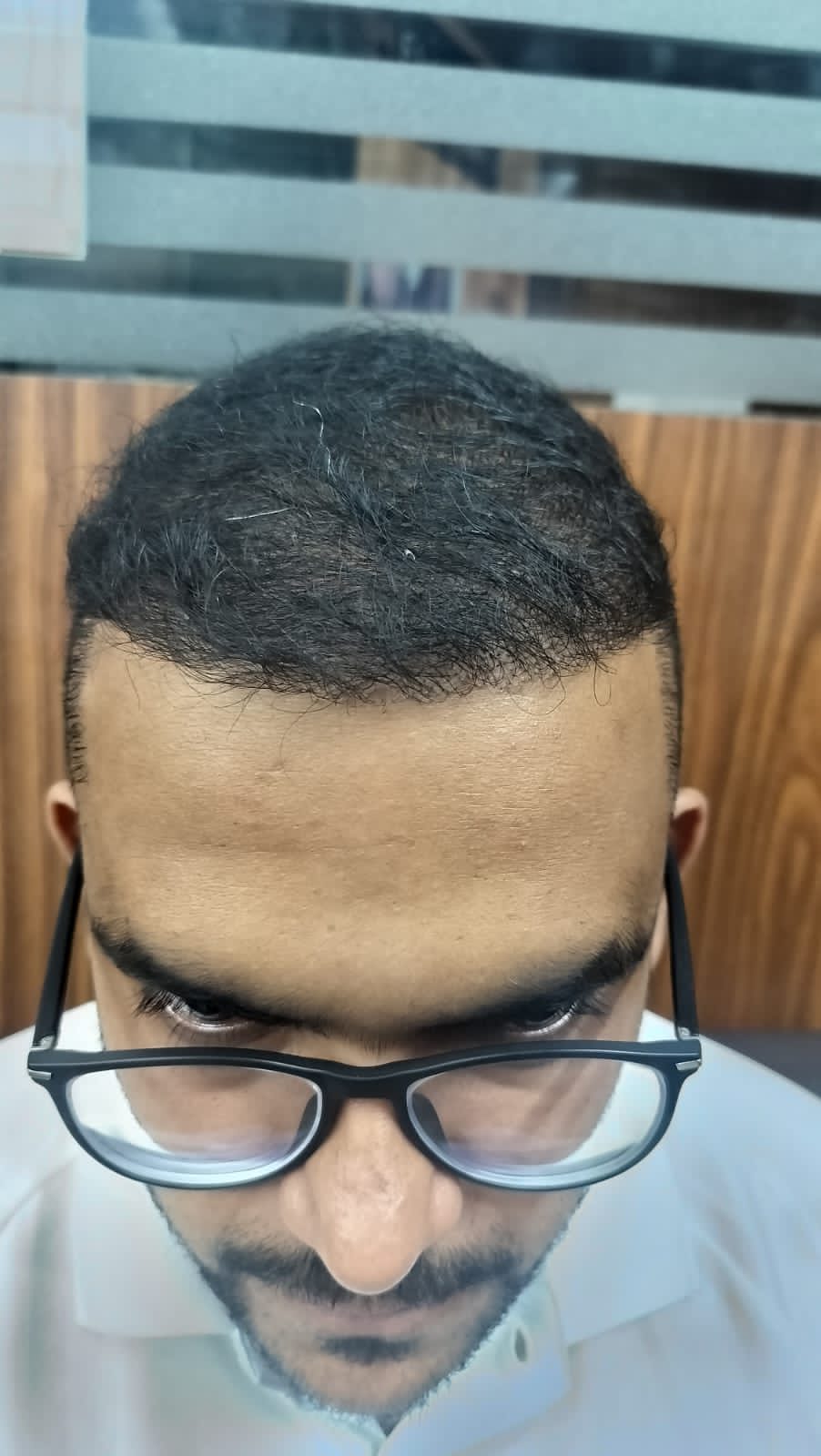 After