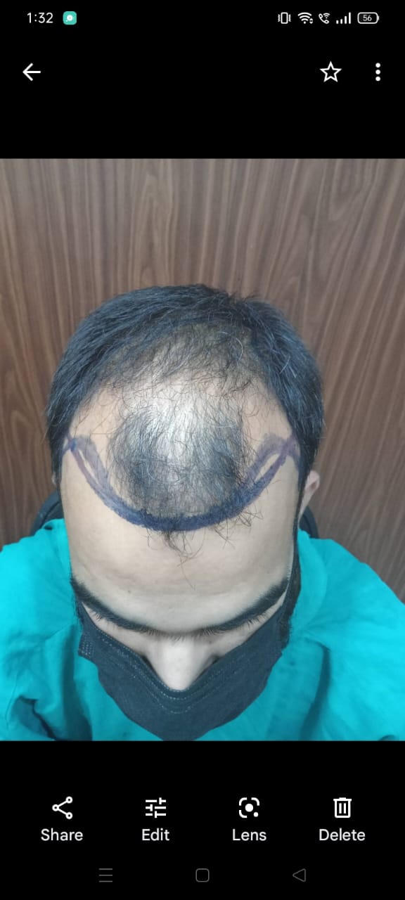 After