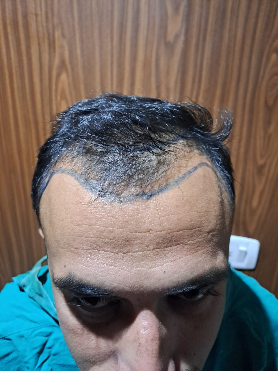 Before