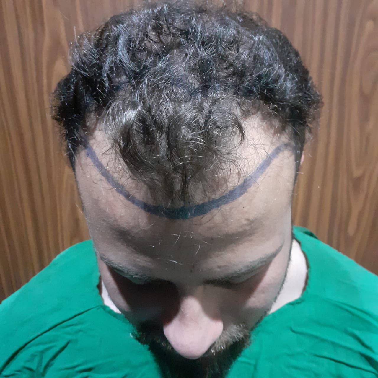 Before