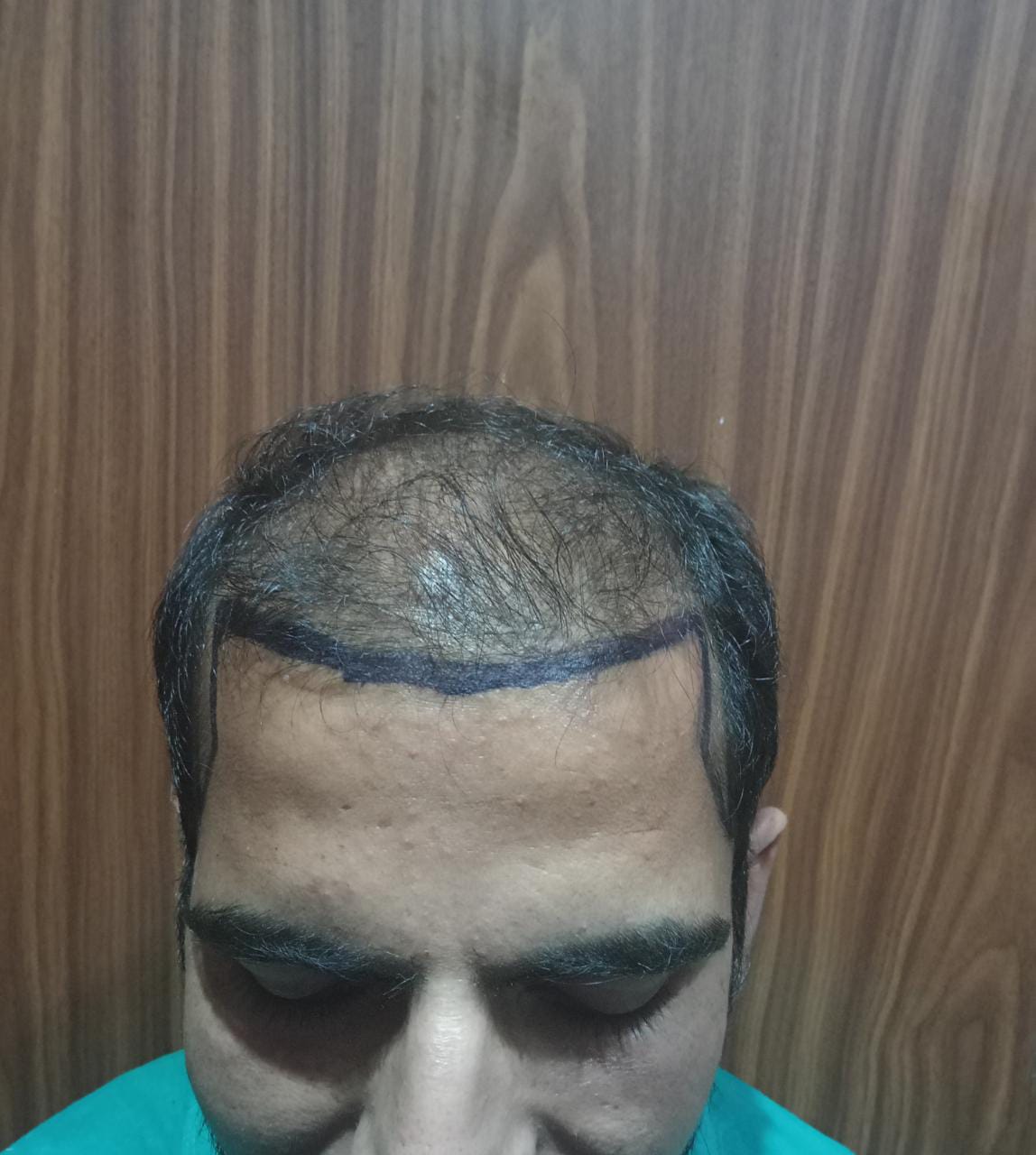 Before