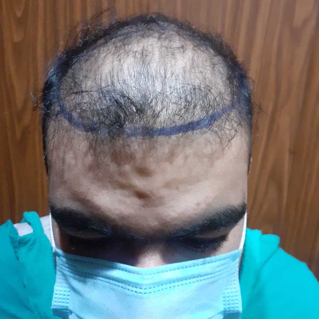 Before